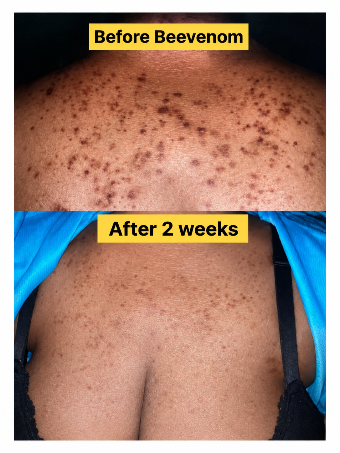 Before and After Body