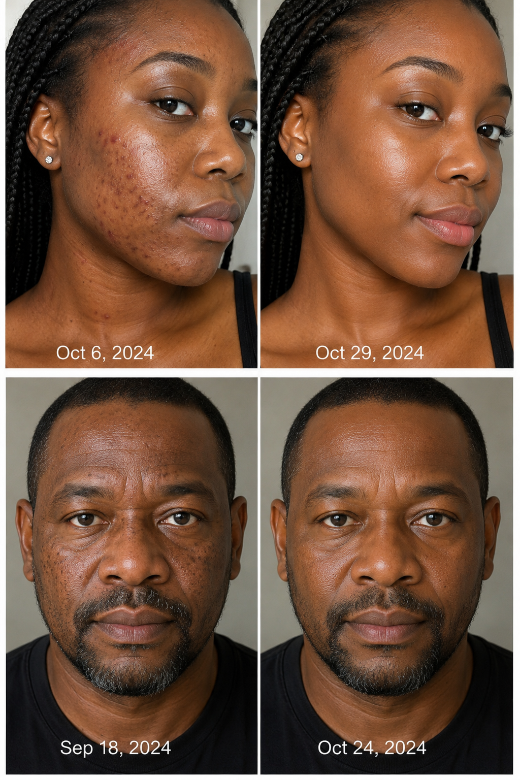 Before and After Face